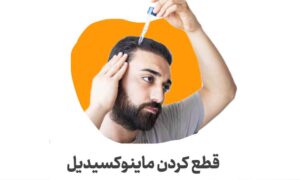 قطع کردن ماینوکسیدیل